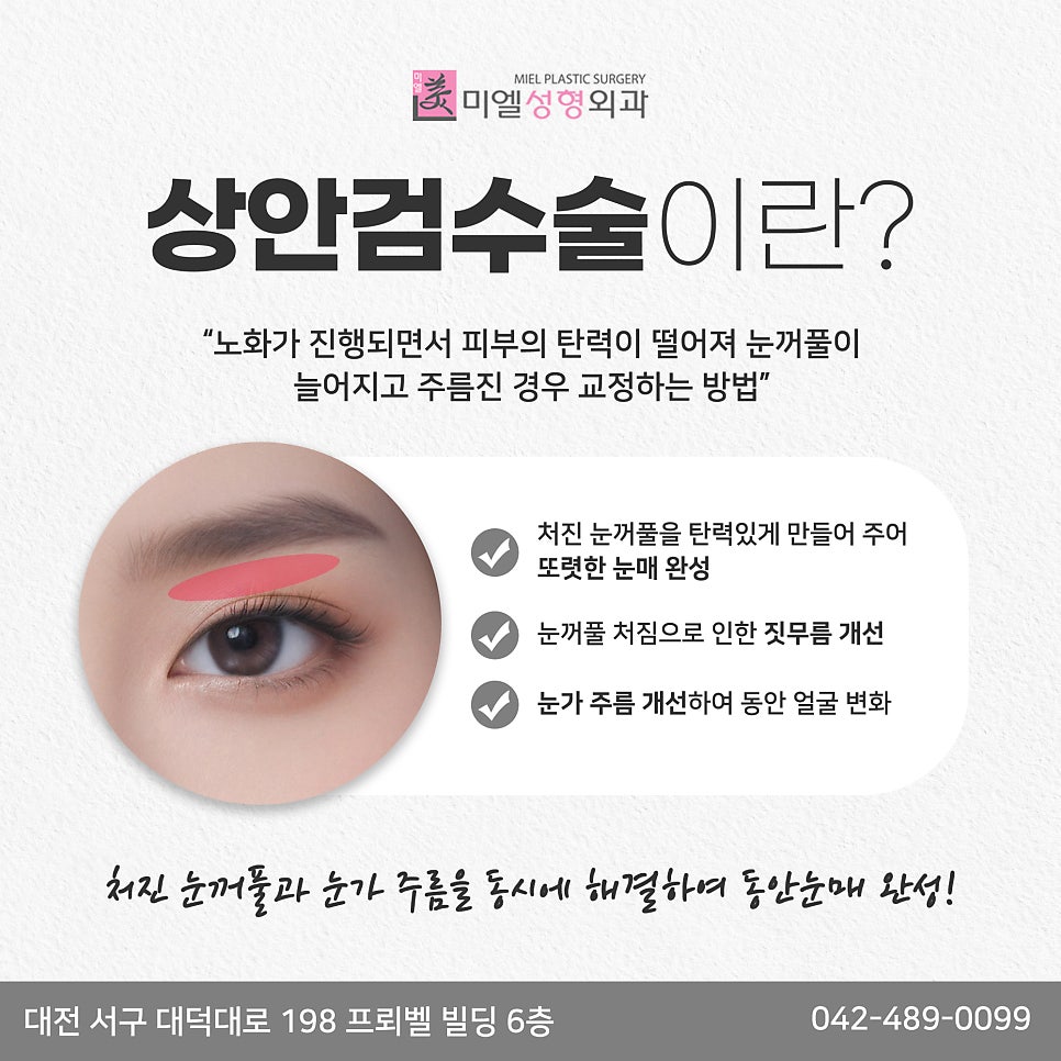 미엘성형외과 이미지