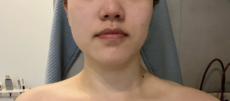 조은얼굴 에스테틱 진해본점 이미지