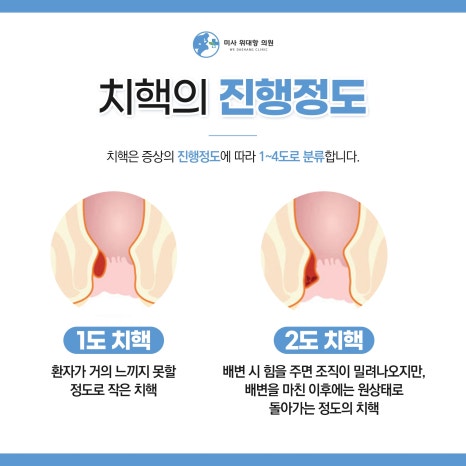 미사위대항의원 이미지