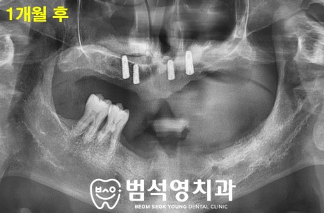 범석영치과 이미지
