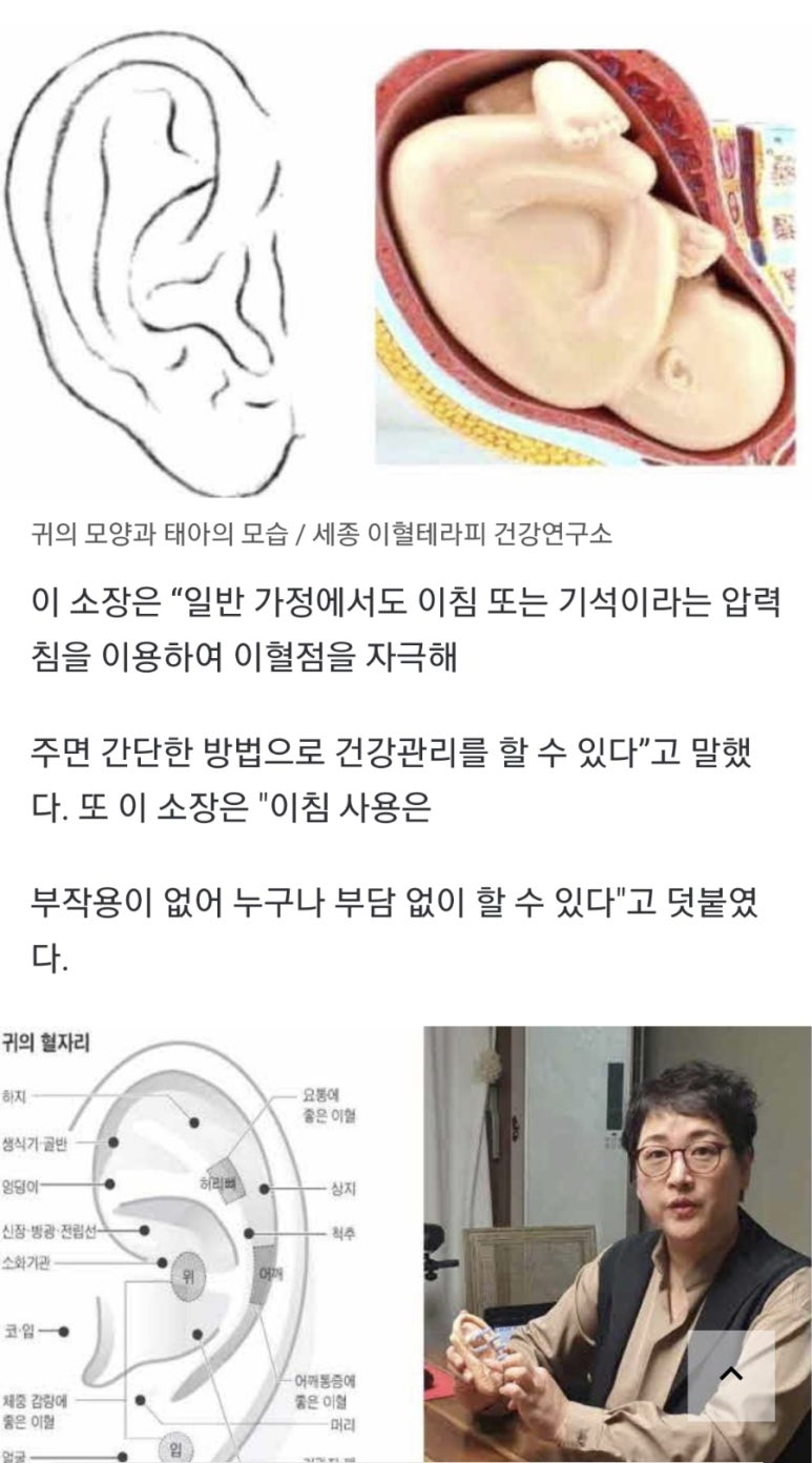 왕쑥뜸테라피 이미지