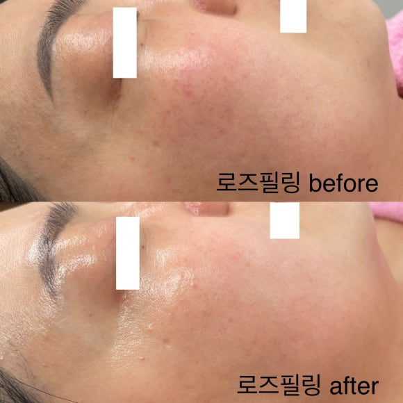 오르뷰티 이미지