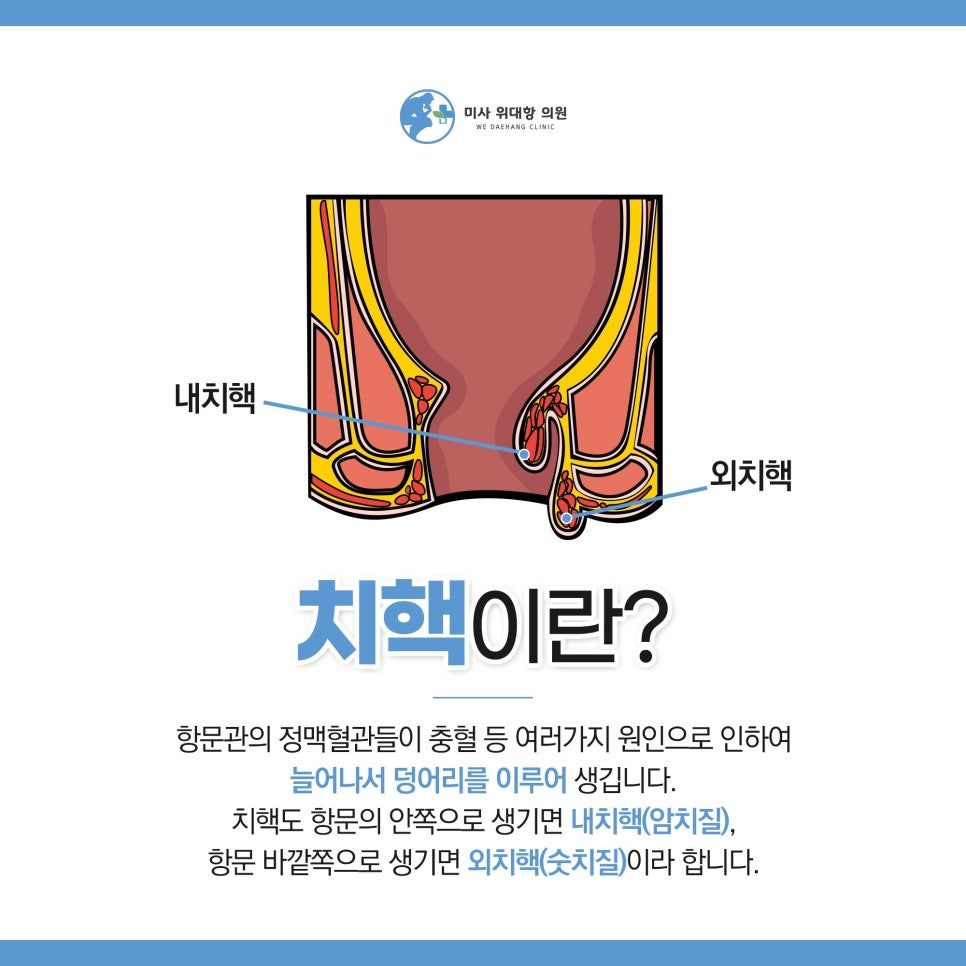 미사위대항의원 이미지
