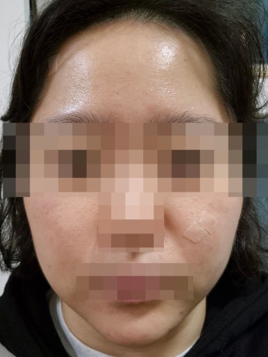 예인피부과의원 이미지