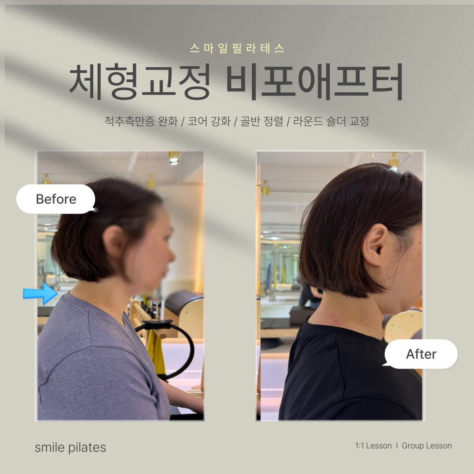 스마일체형교정센터 이미지
