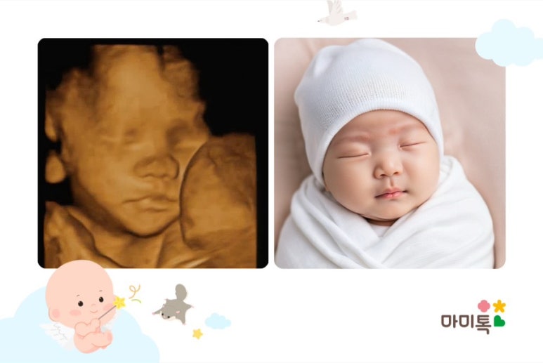 청개구리마미 이미지