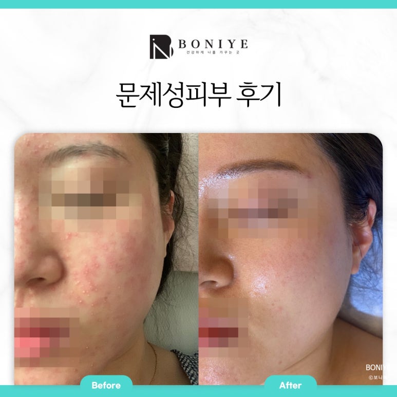보니예 이미지