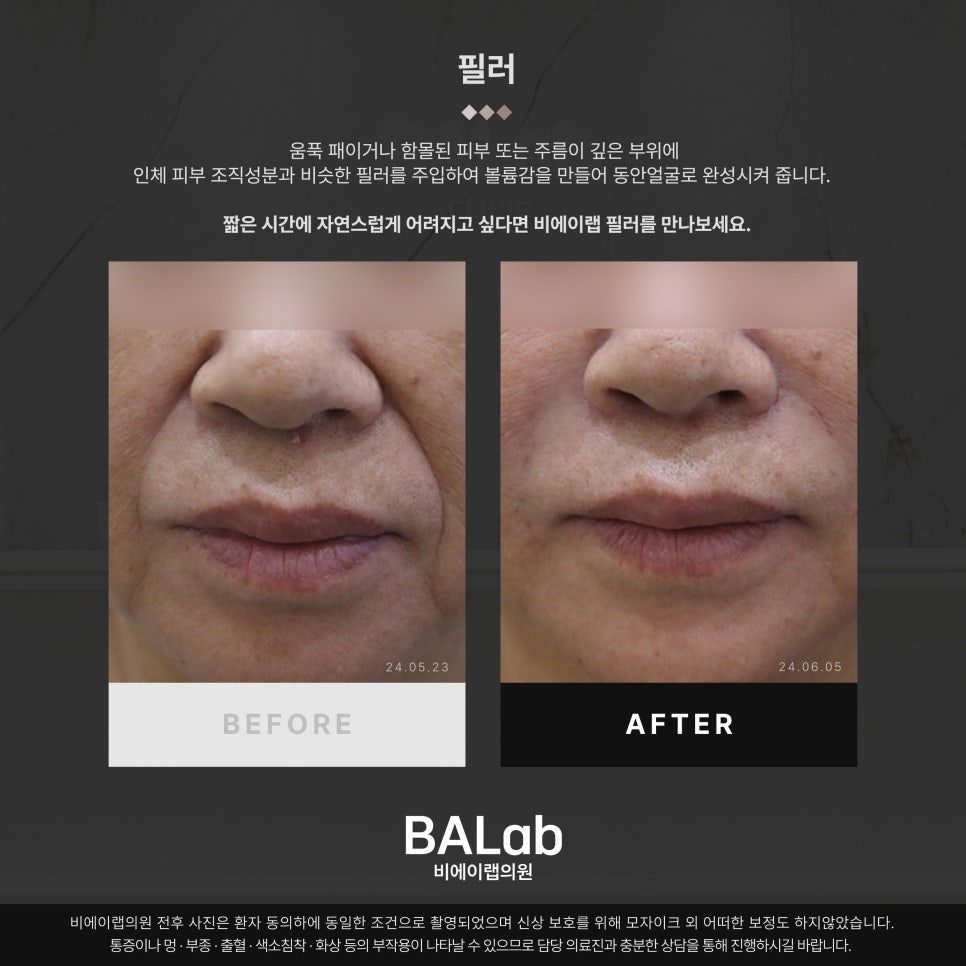 비에이랩의원 이미지