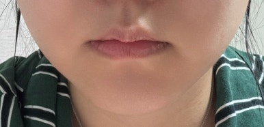 리부팅의원 이미지