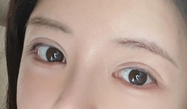 아이그램성형외과 이미지