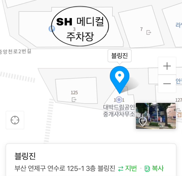 블링진 이미지