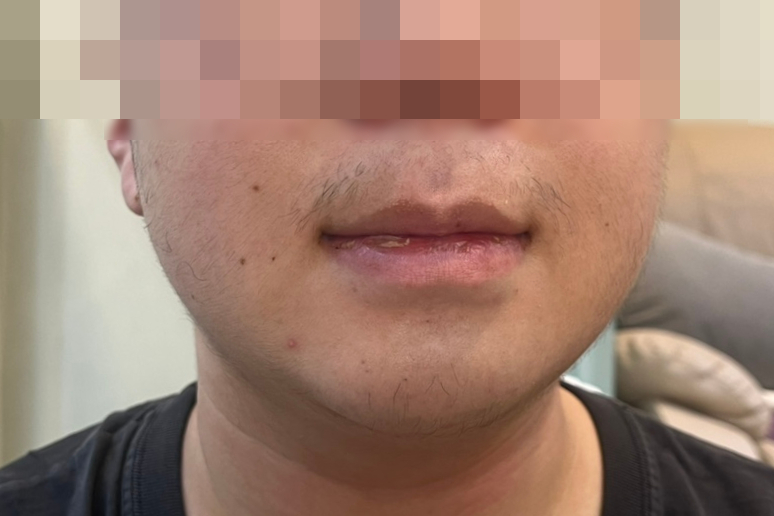 피카브로우 이미지