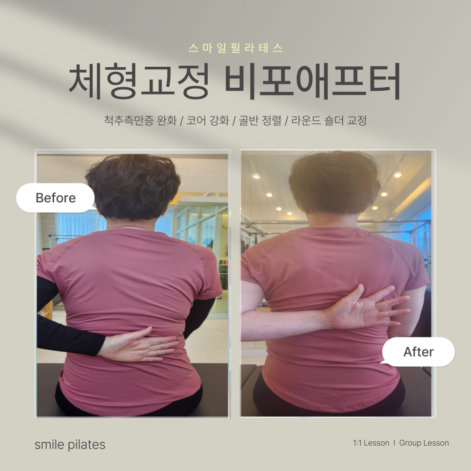 스마일체형교정센터 이미지