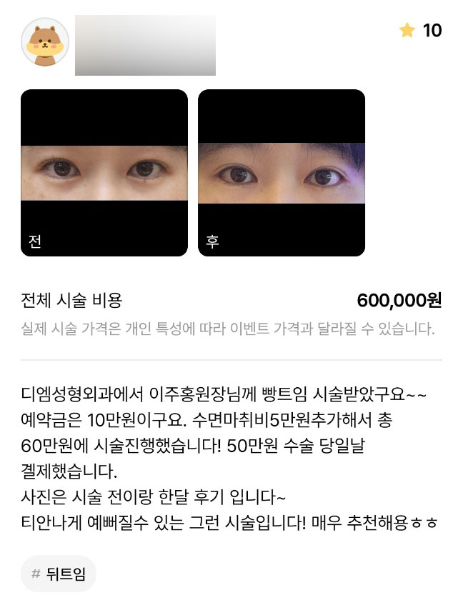 비디엠티 이미지