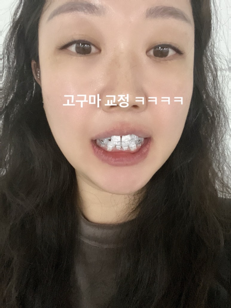 서면예치과 이미지