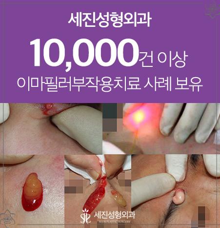 세진기초 이미지