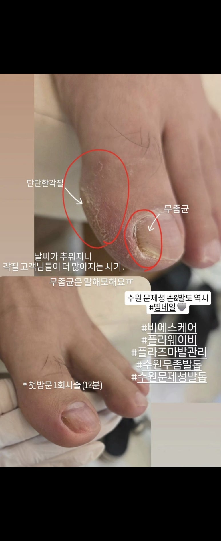 비에스케어 이미지
