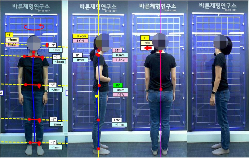 한국바른체형연구소 이미지