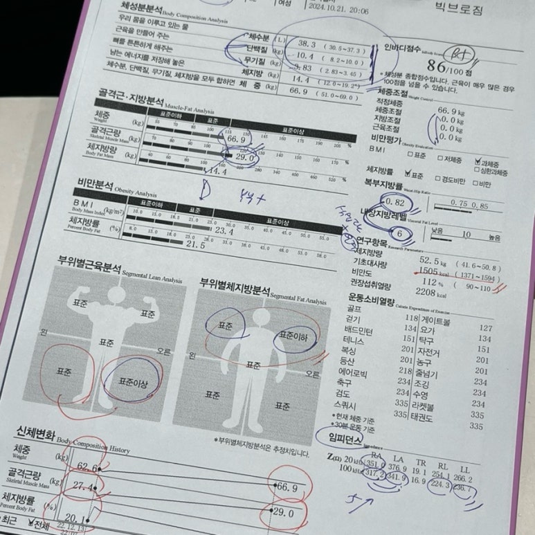 빅브로짐 이미지