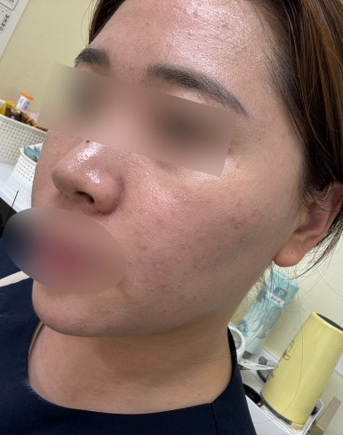 뉴본 스킨케어 이미지