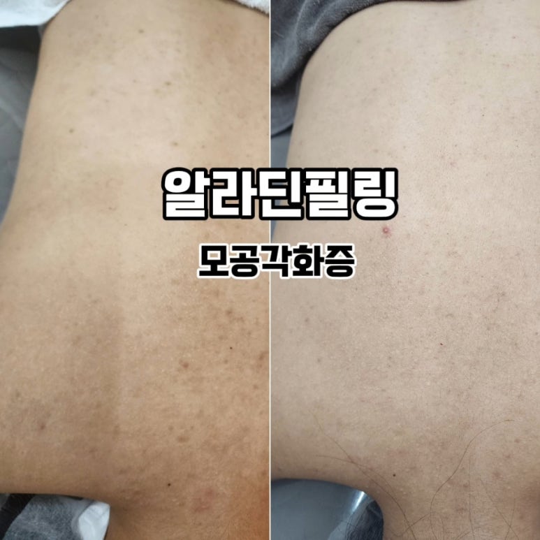 뷰티하리 김포점 이미지
