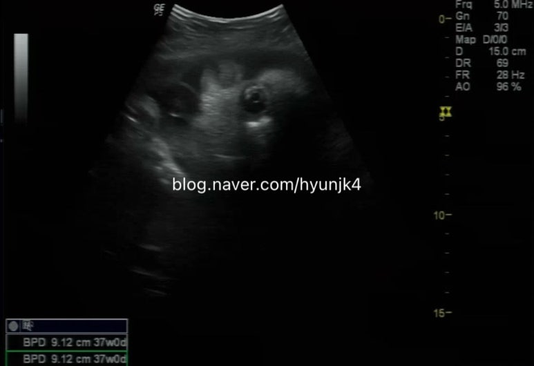 우먼피아여성병원 이미지