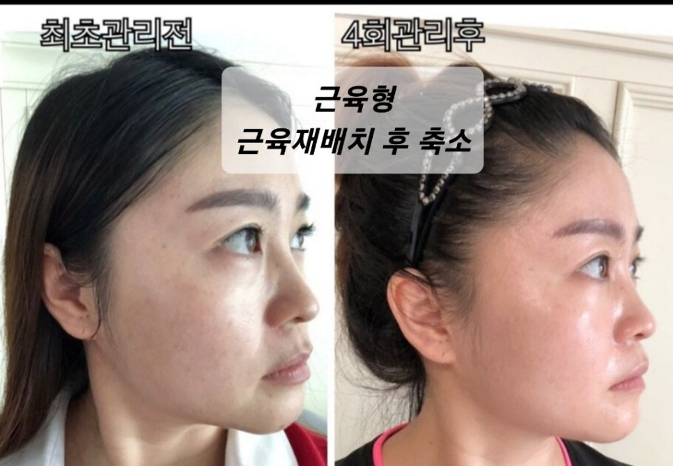 뷰티라인 이미지