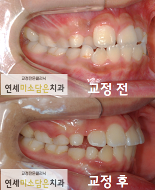 연세미소담은치과 이미지