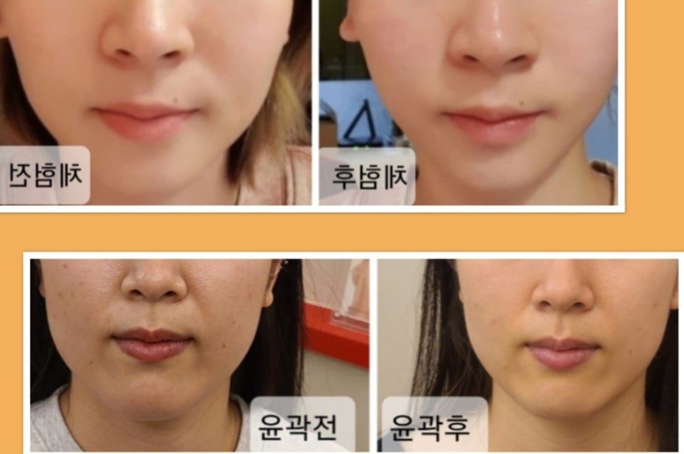 뷰티라인 이미지
