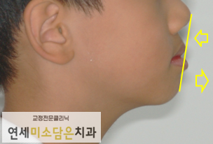 연세미소담은치과 이미지