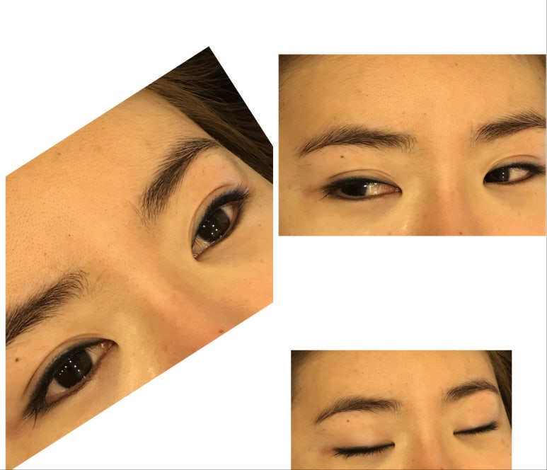 뷰티라인 이미지