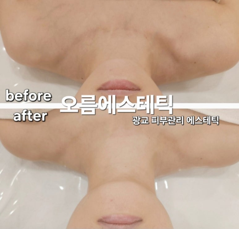 오름에스테틱 이미지