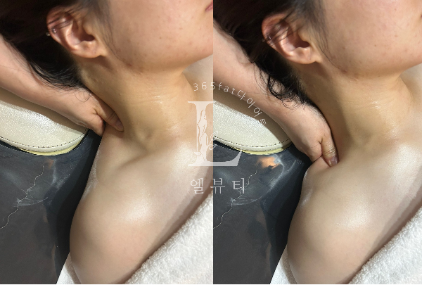 365뷰티라인 이미지