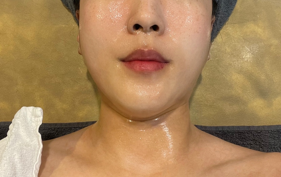 엔쏘에스테틱 이미지