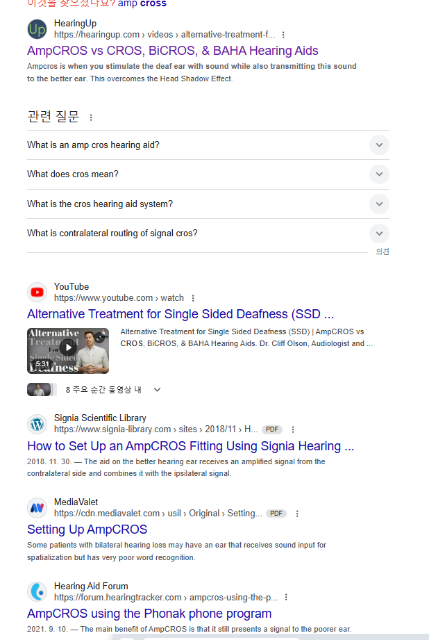 편측성 난청에서 AMP CROS란?(국내최소 소개!) — 원문 이미지 12
