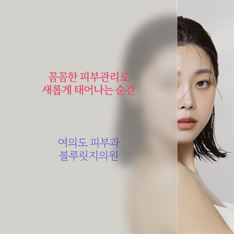 텐체형관리 이미지