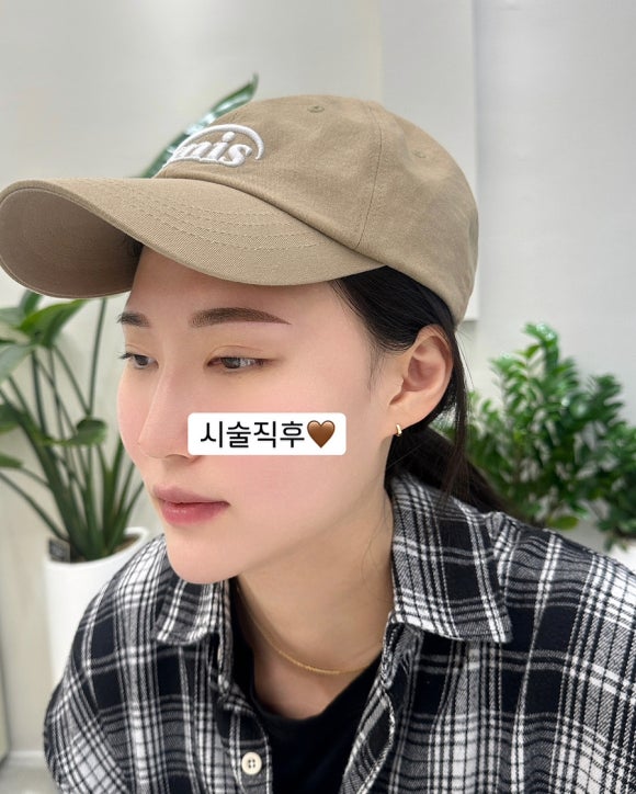 링링브로우 이미지