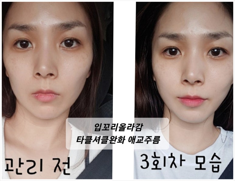 뷰티라인 이미지