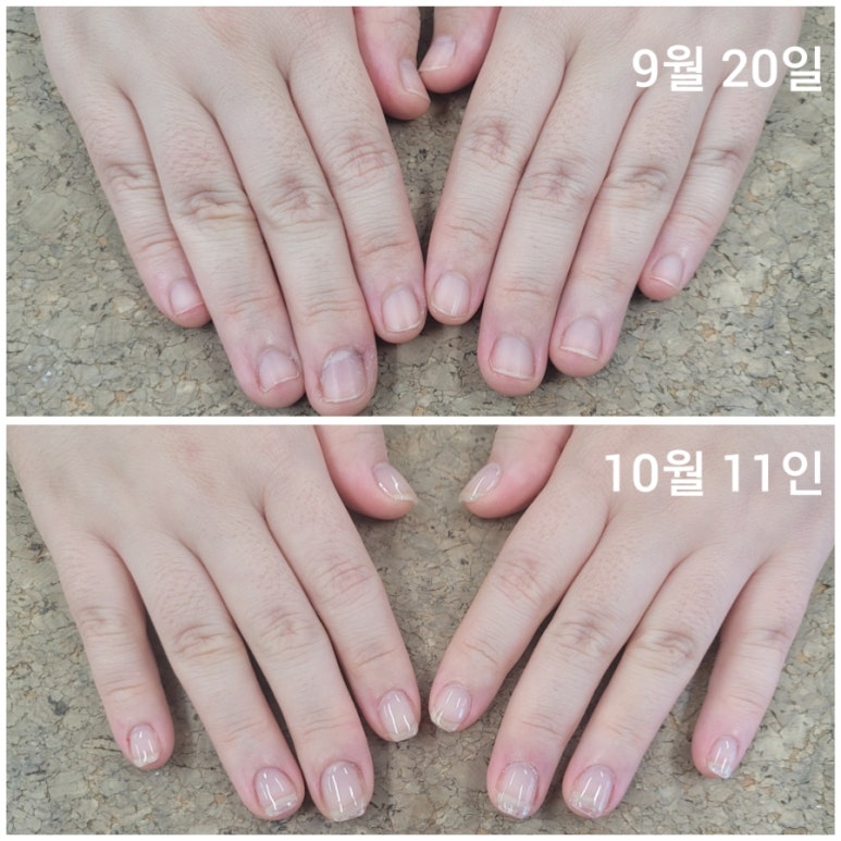 씨티네일 이미지