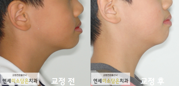 연세미소담은치과 이미지