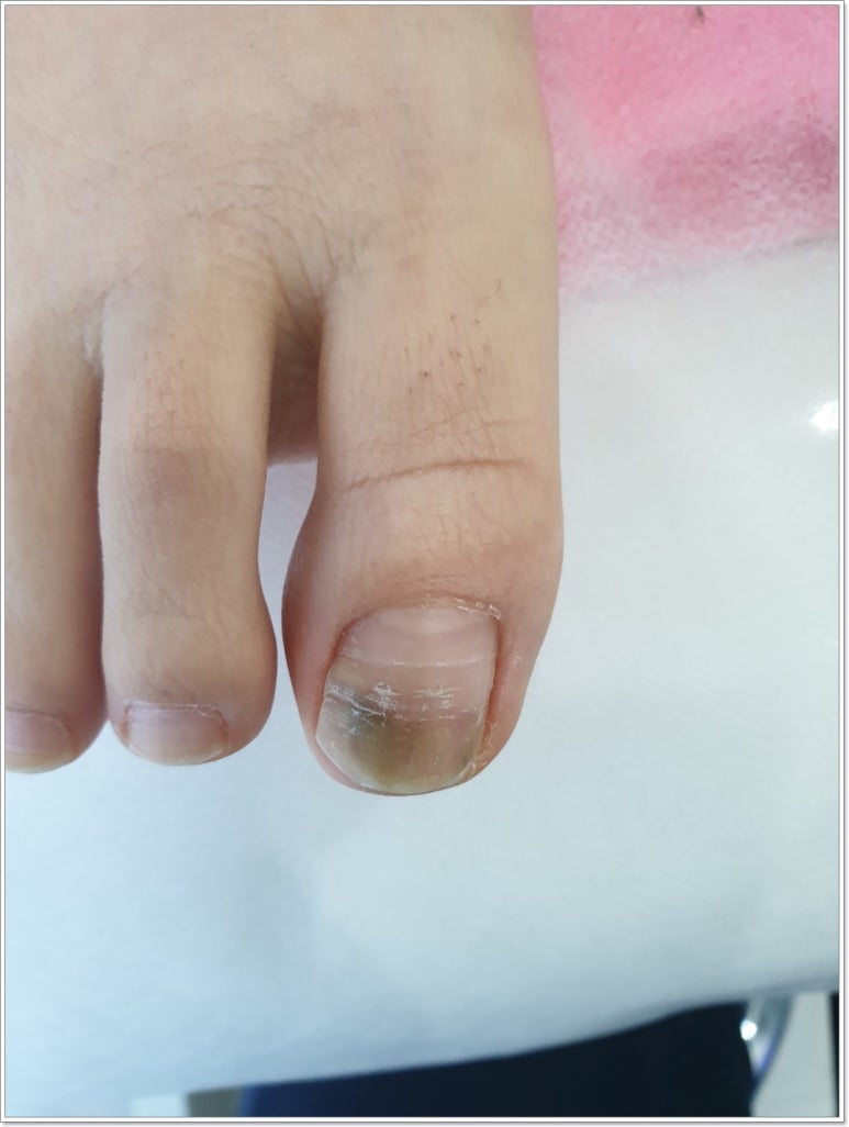 미미체형관리 이미지