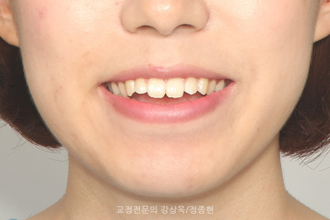 예쁜치아만들기치과의원 이미지