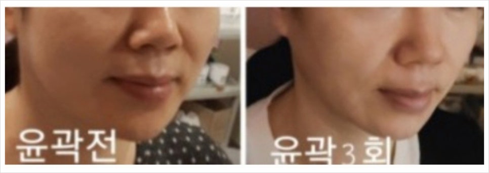 비키뷰티 이미지