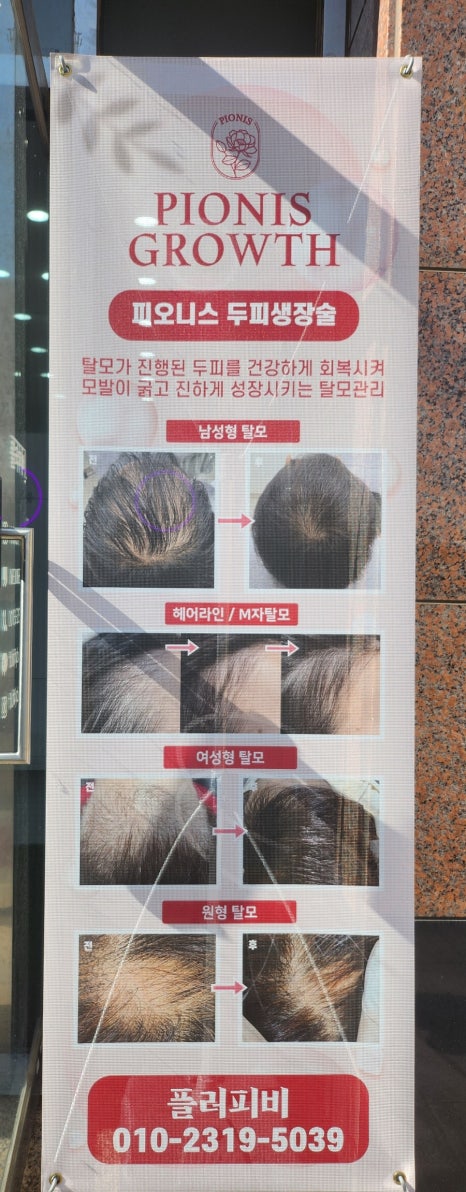 플러피비네일 이미지