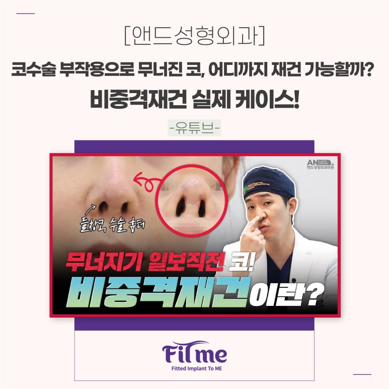 코어디 이미지