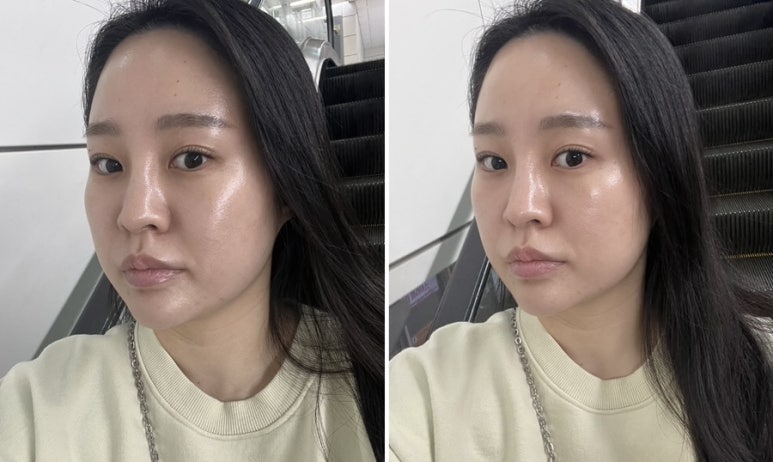 제이에스에스테틱 이미지