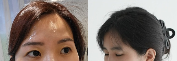 인브로우 이미지
