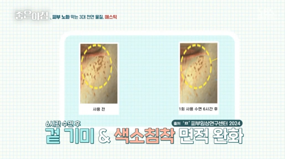 화이트화장품 이미지