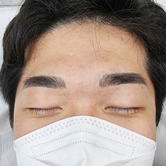 브로우결 이미지