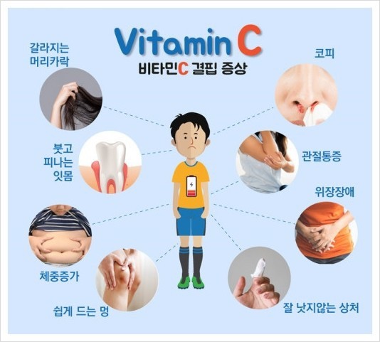 오오핏 이미지